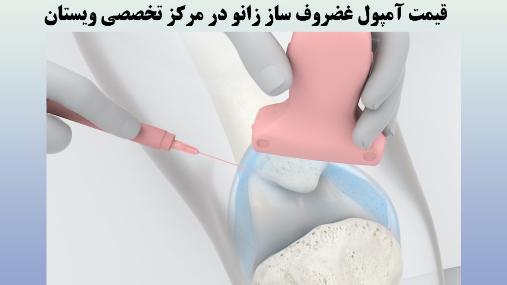 یک آمپول در حال تزریق به زانو-نوشته :قیمت آمپول غضروف ساز زانو