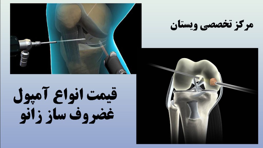 دو تصویر دیجیتالی از تزریق آمپول به زانو