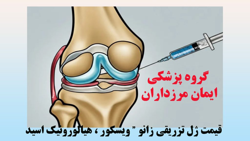 تصویر انیمیشنی از تزریق آمپول به زانو