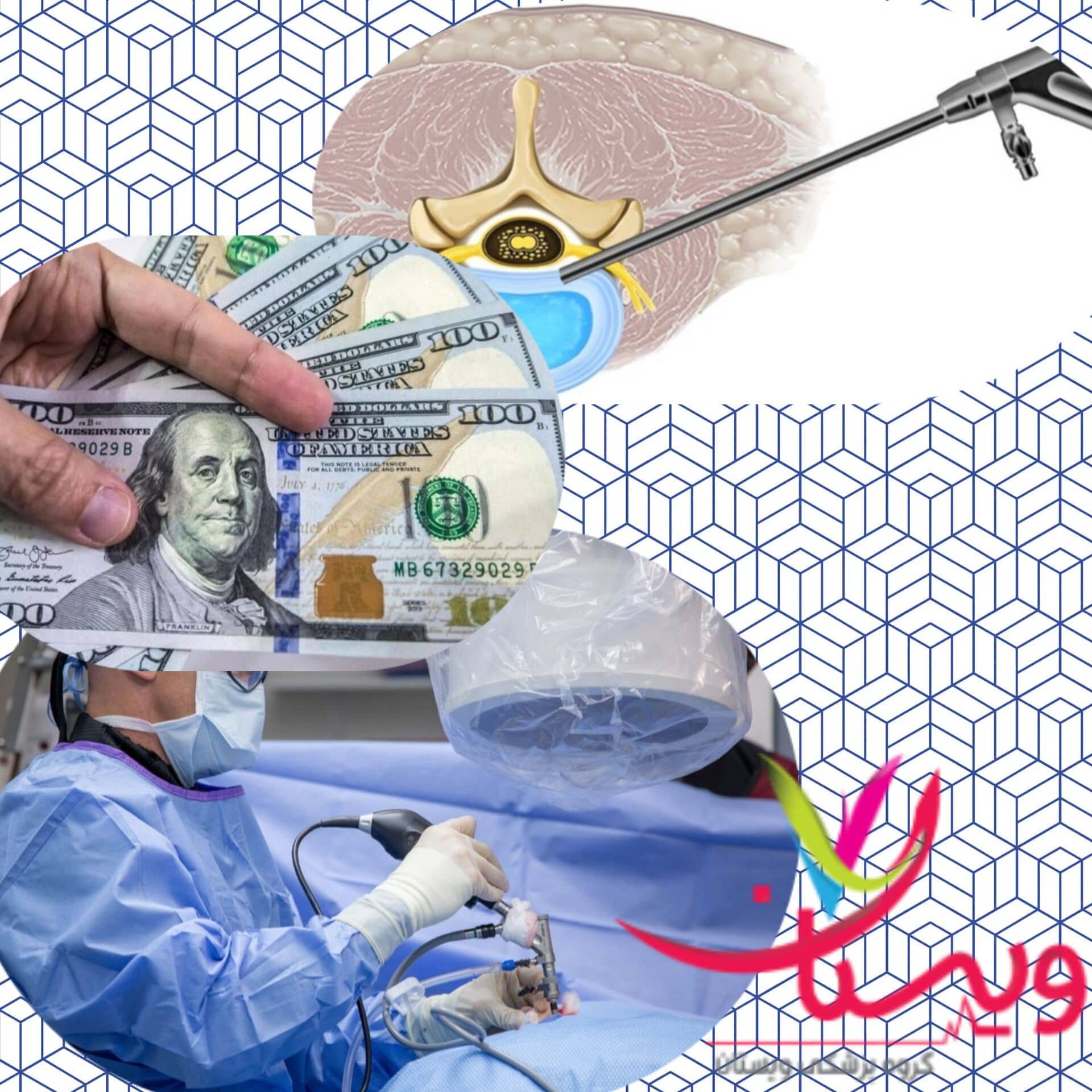 هزینه عمل میکروسکوپی دیسک کمر +هزینه عمل دیسک کمر در سال1404