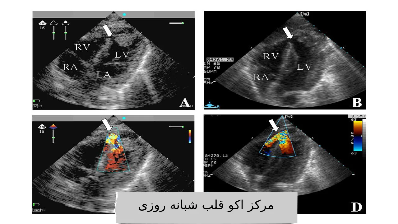 مرکز اکو قلب شبانه روزی