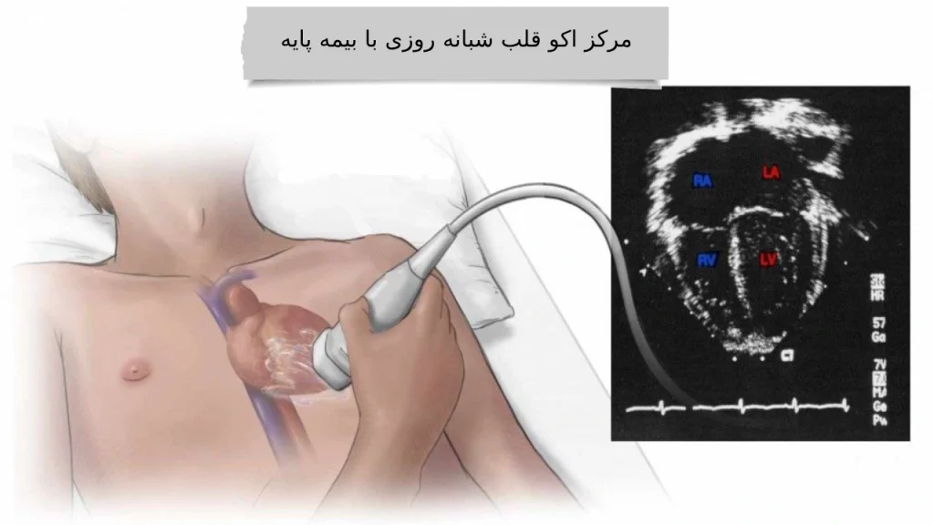 مرکز اکو قلب شبانه روزی با بیمه پایه بیمه پابه برای اکو قلب چثدر و چطور است؟