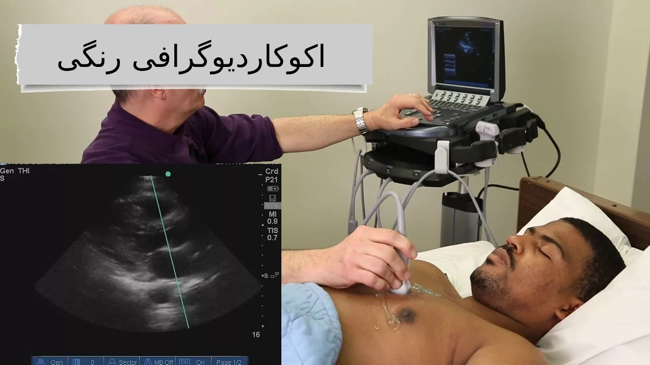 اکوکاردیوگرافی رنگی