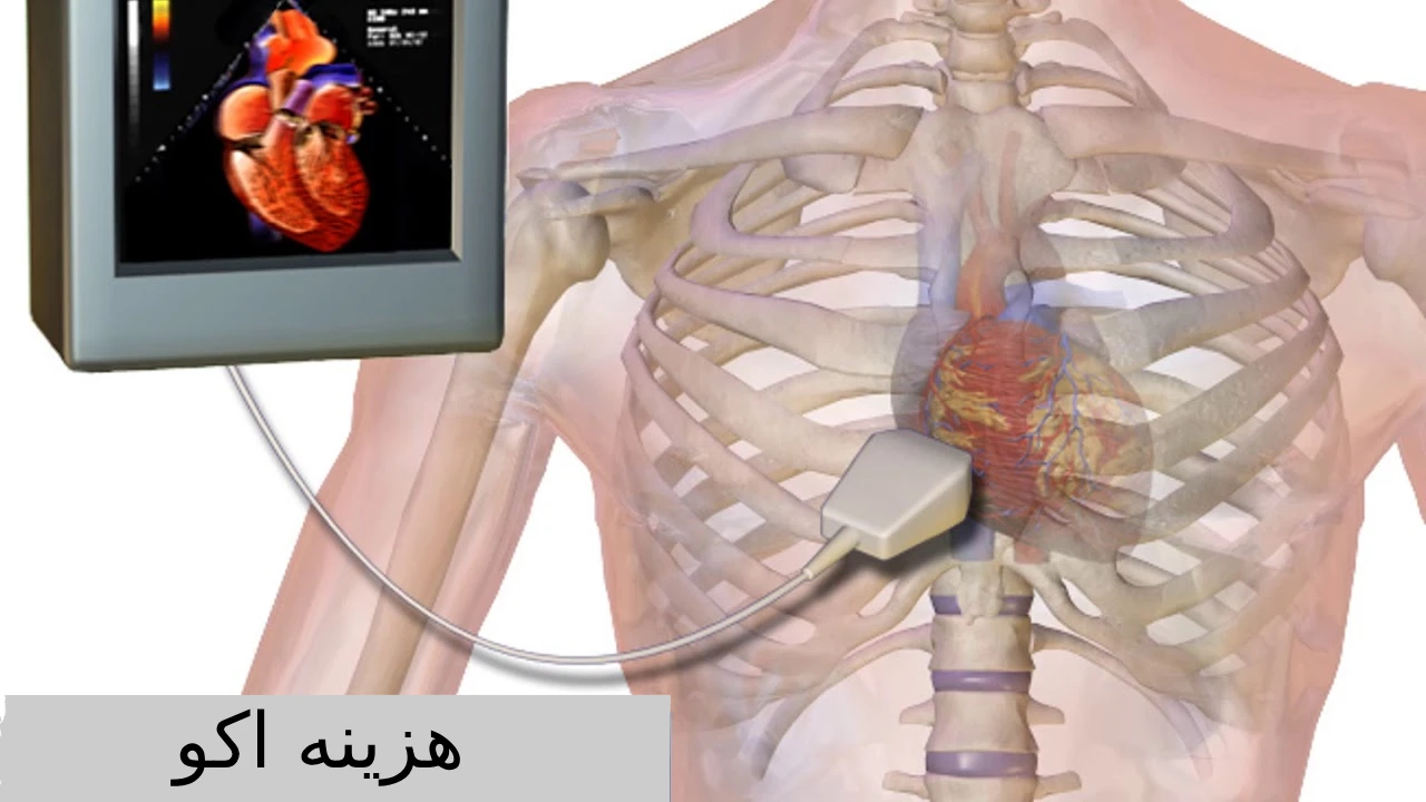 هزینه اکو