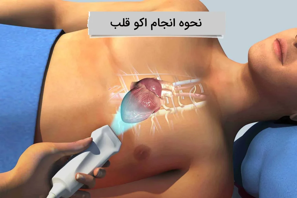 نحوه انجام اکو قلب اکو قلب چگونه است