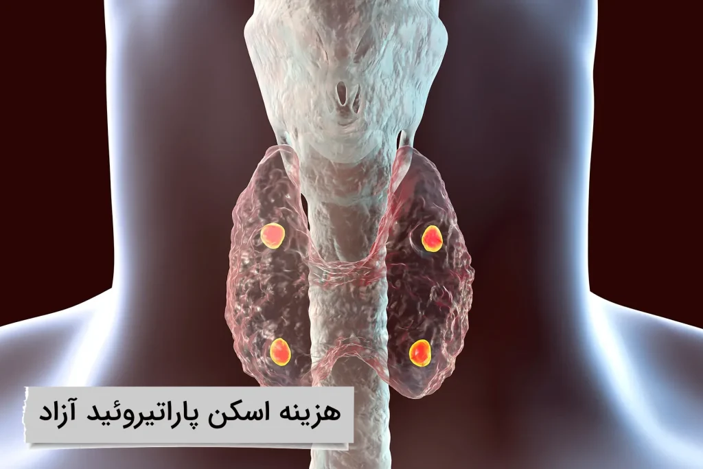 هزینه اسکن پاراتیروئید بدون بیمه چقدر است