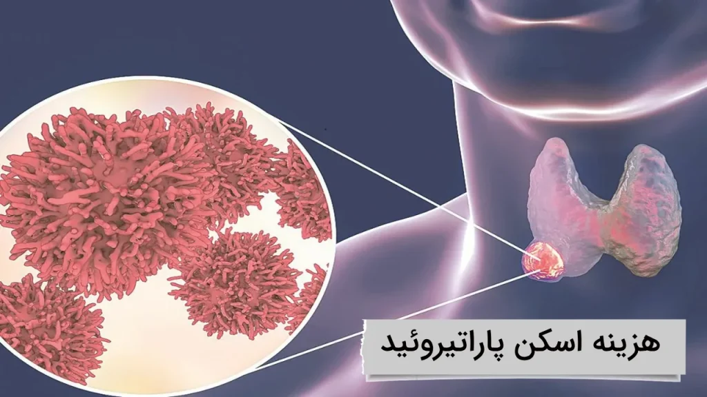 هزینه اسکن پاراتیروئید