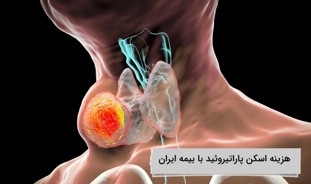 پوشش بیمه ایران چقدر است