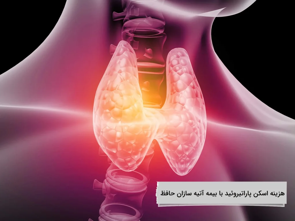 هزینه اسکن پاراتیروئید با بیمه آتیه سازان حافظ پوشش بیمه آتیه سازان حافظ چقدر است