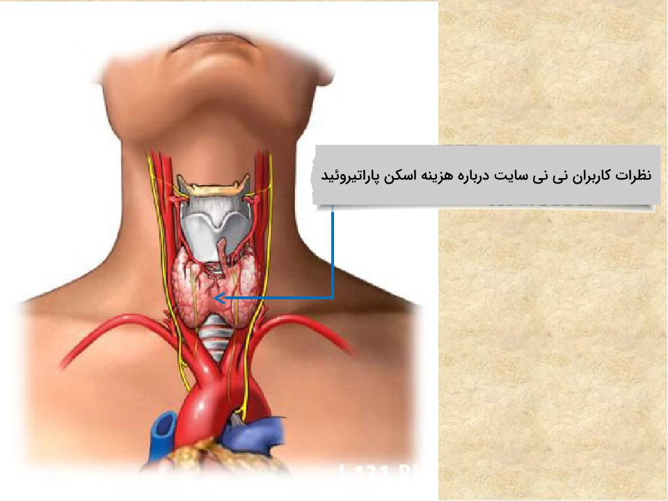 نظرات کاربران نی نی سایت درباره هزینه اسکن پاراتیروئید نظرات کاربران نی نی سایت