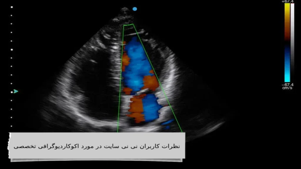 نظرات کاربران نی نی سایت در مورد اکوکاردیوگرافی تخصصی دقیق ترین اکوکاردیوگرافی تخصصی