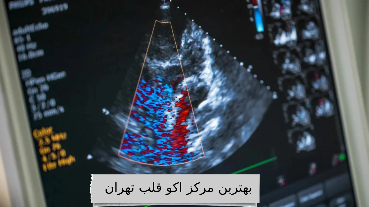 بهترین مرکز اکو قلب تهران