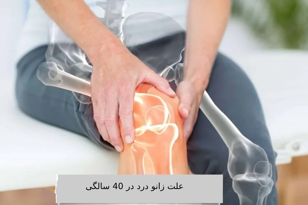 علت زانو درد در 40 سالگی