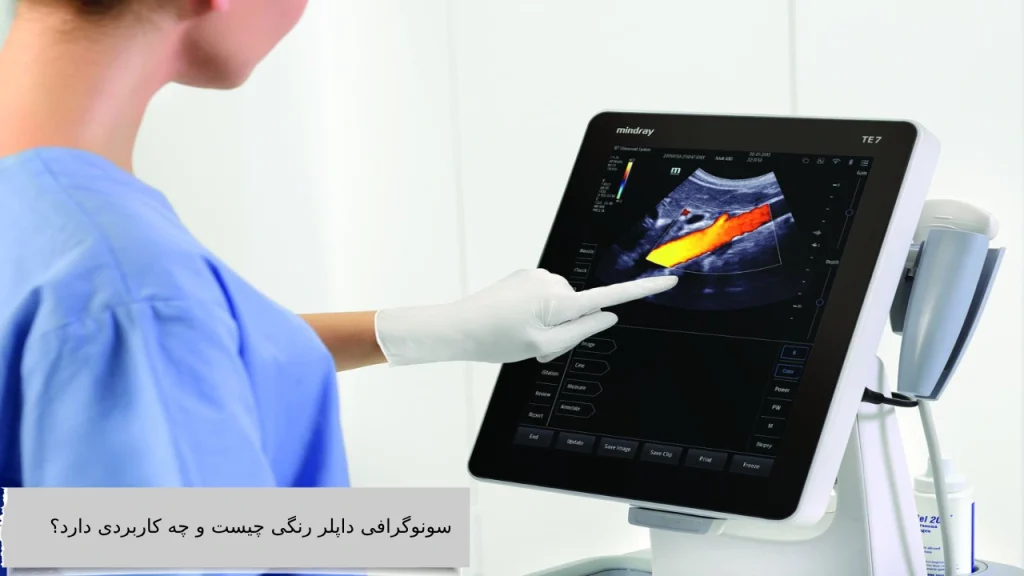 سونوگرافی داپلر رنگی چیست و چه کاربردی دارد؟