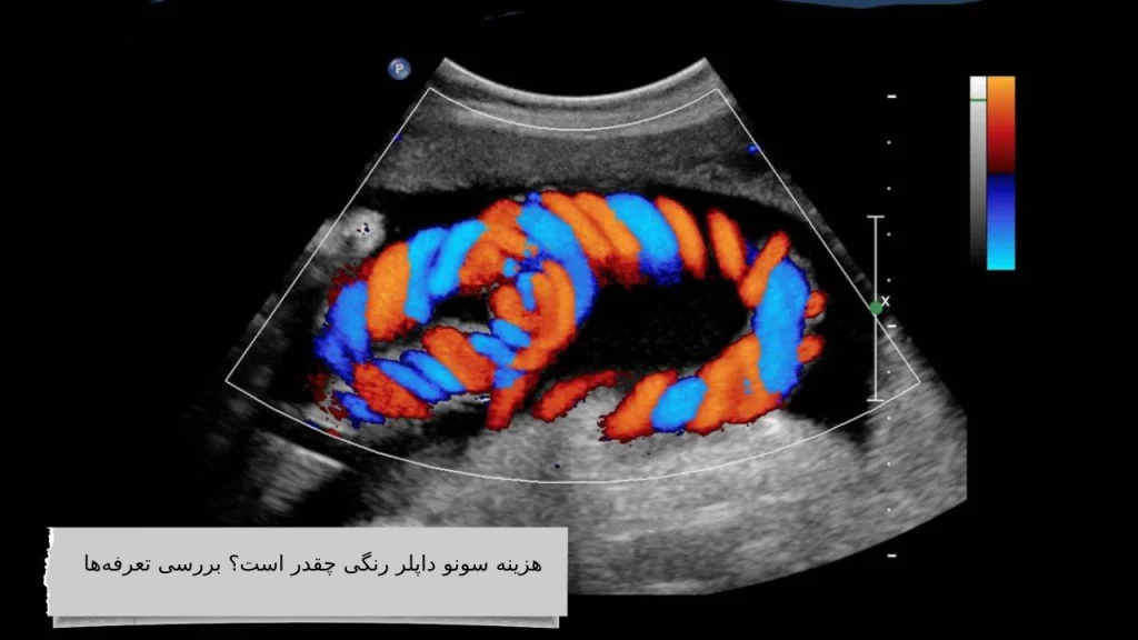 هزینه سونو داپلر رنگی چقدر است؟ بررسی تعرفه‌ها