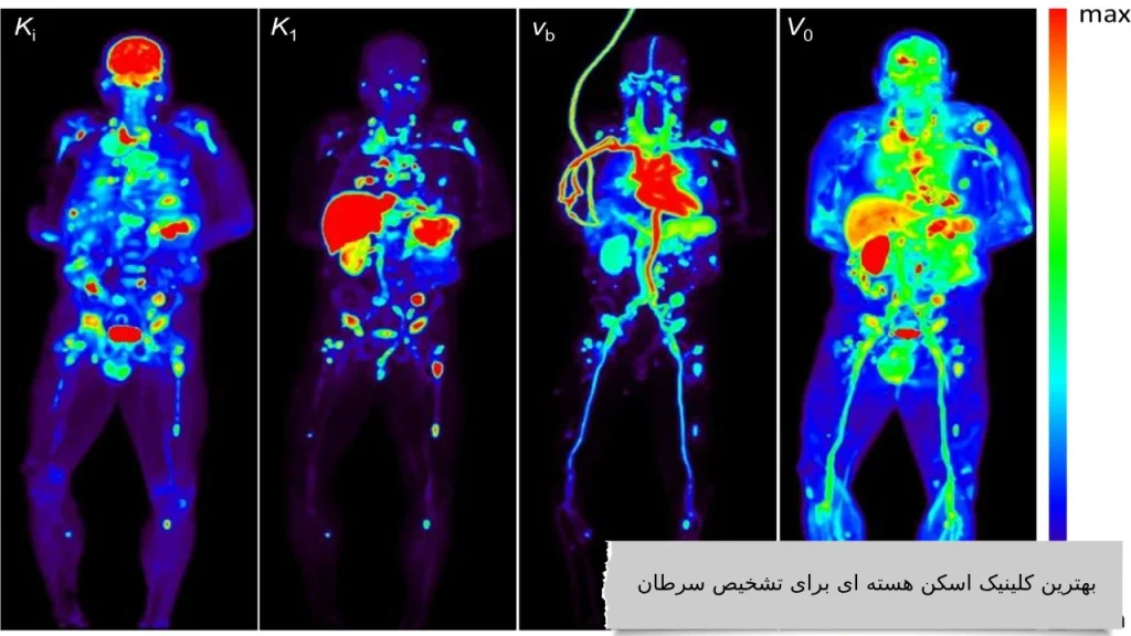 بهترین کلینیک اسکن هسته ای برای تشخیص سرطان را بشناسید