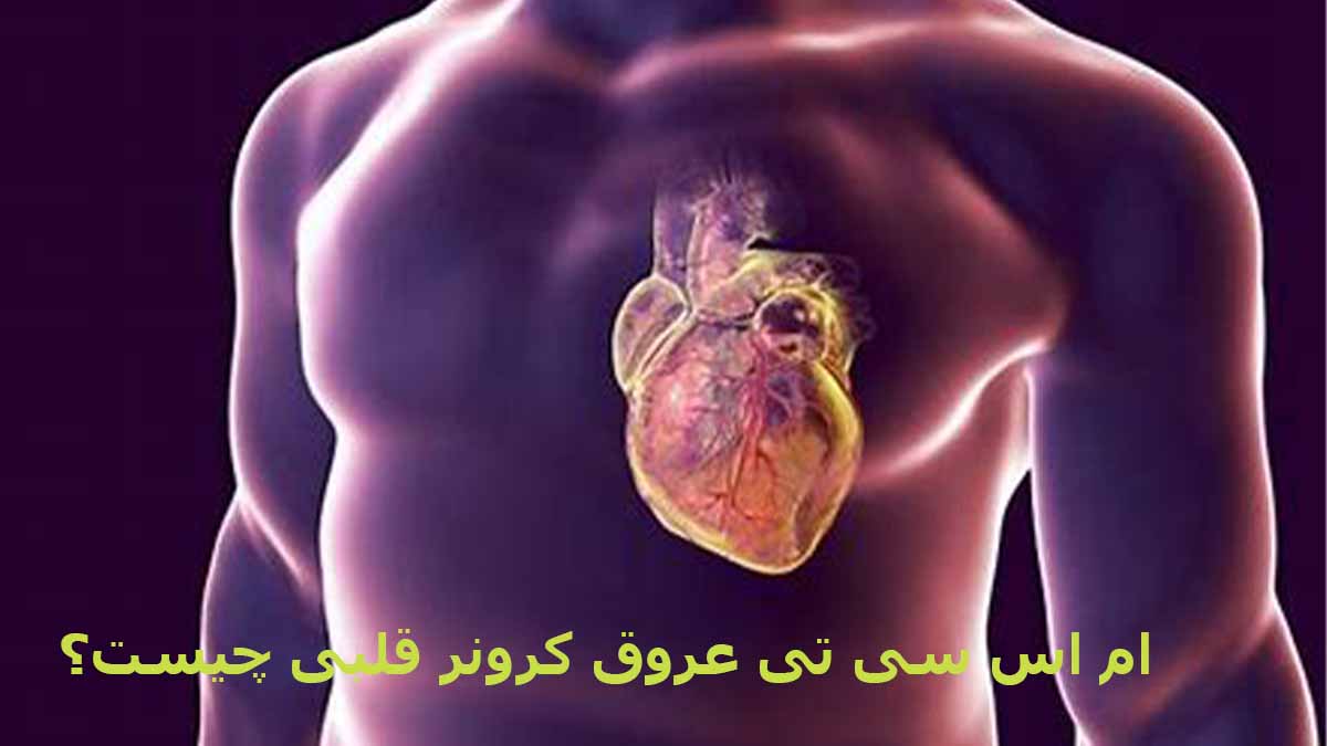 ام اس سی تی عروق کرونر قلب چیست؟