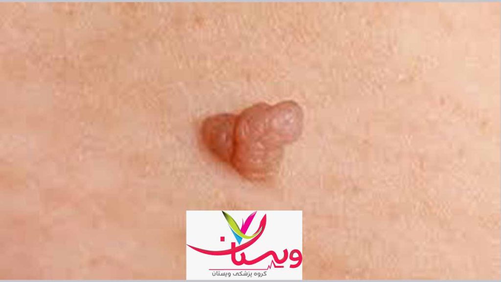 اهمیت پیگیری‌های منظم و رعایت توصیه‌های پزشکی