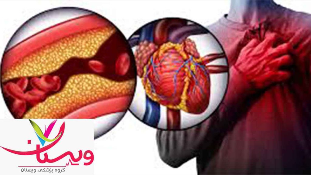 تشخیص زودهنگام با msct عروق کرونر قلب