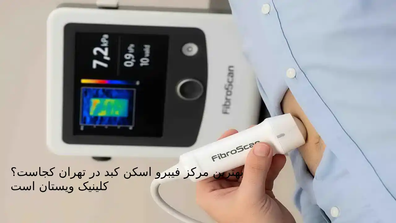 بهترین مرکز قیبرو اسکن کبد در تهران