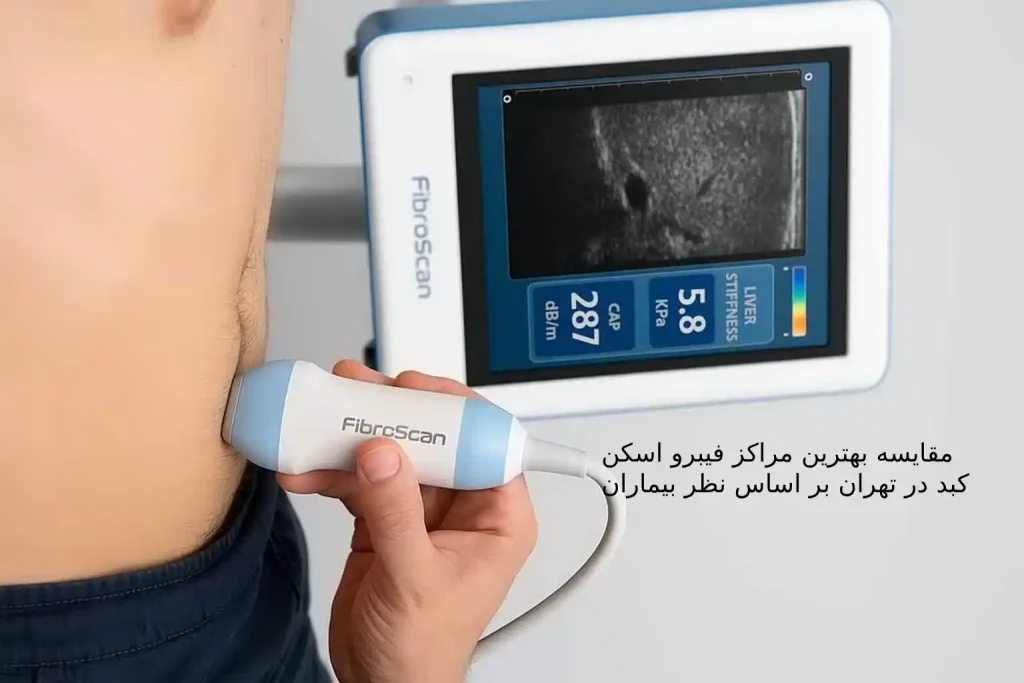 مقایسه بهترین مراکز فیبرو اسکن کبد در تهران