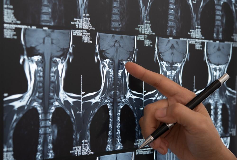 هزینه ام آر آی دیسک کمر هزینه ام آر آی دیسک کمر