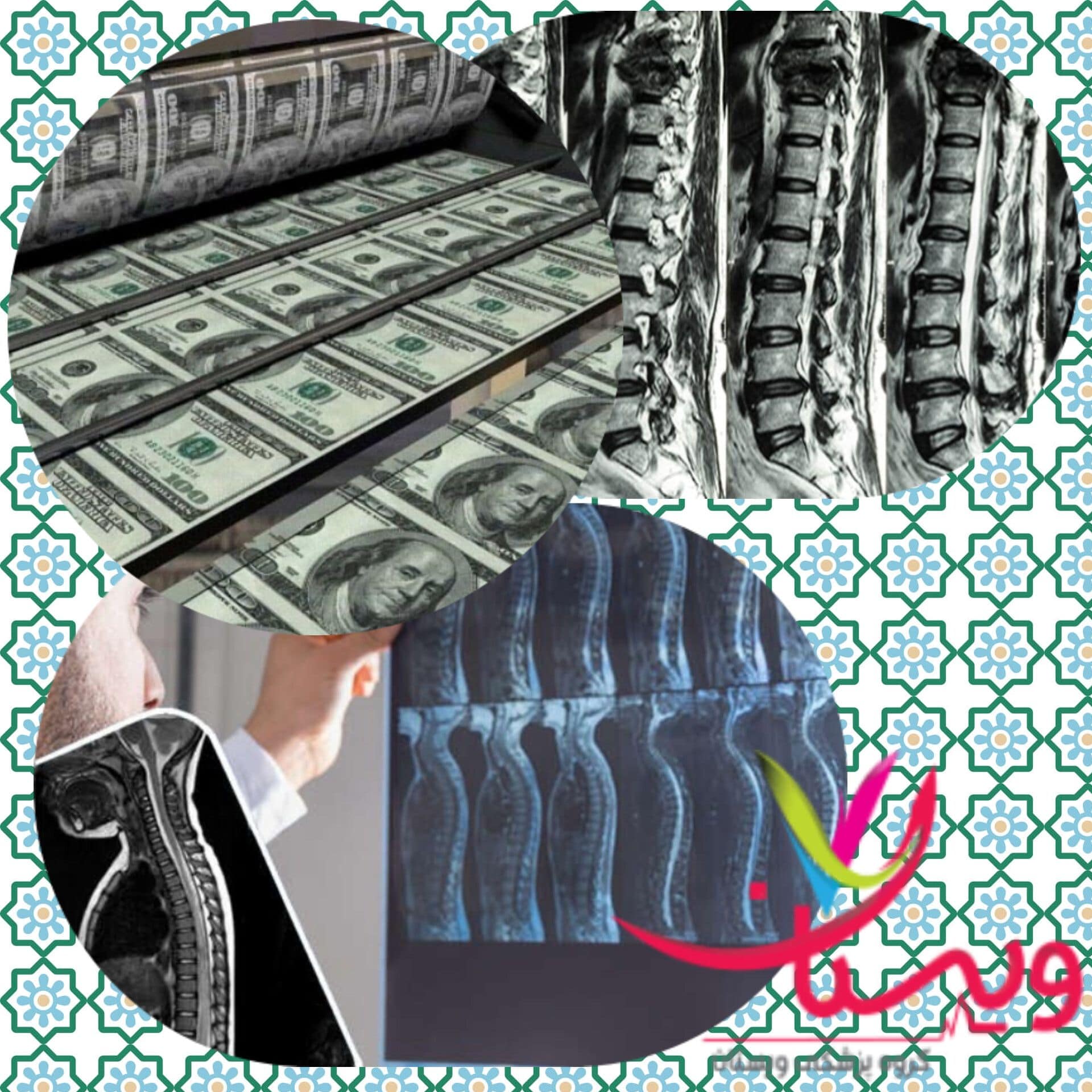 هزینه ام ار ای کمر سال 1404+4لیست از هزینه ام ار ای کمر ازاد