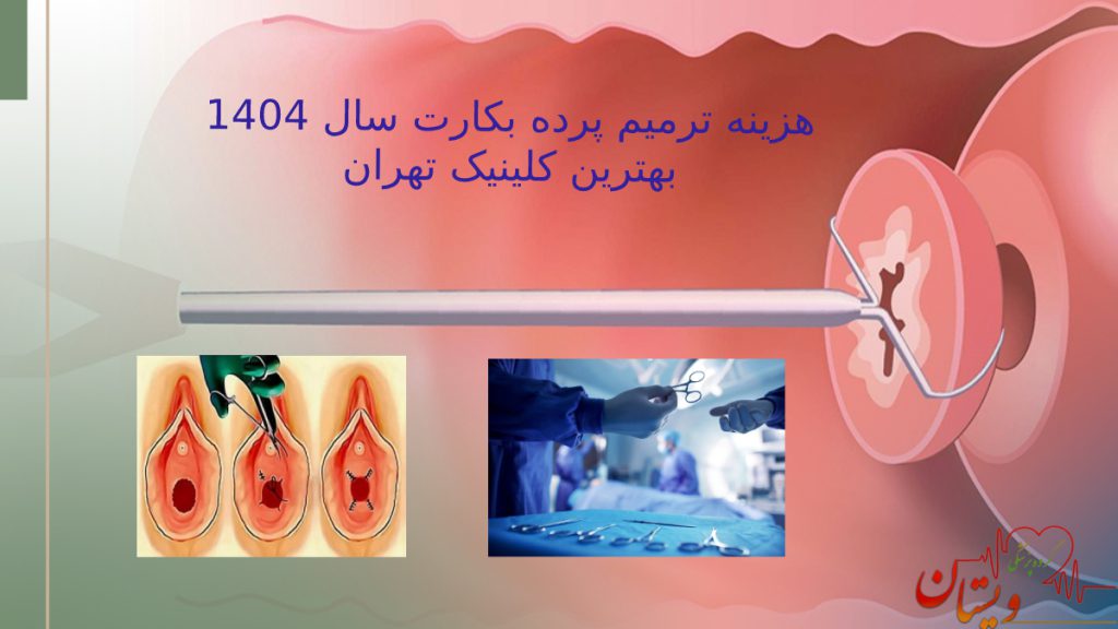 هزینه ترمیم بکارت در سال 1404 چقدر است؟