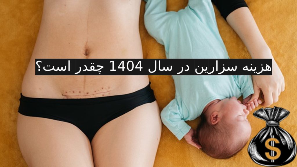 هزینه سزارین در سال 1404 چقدر است؟