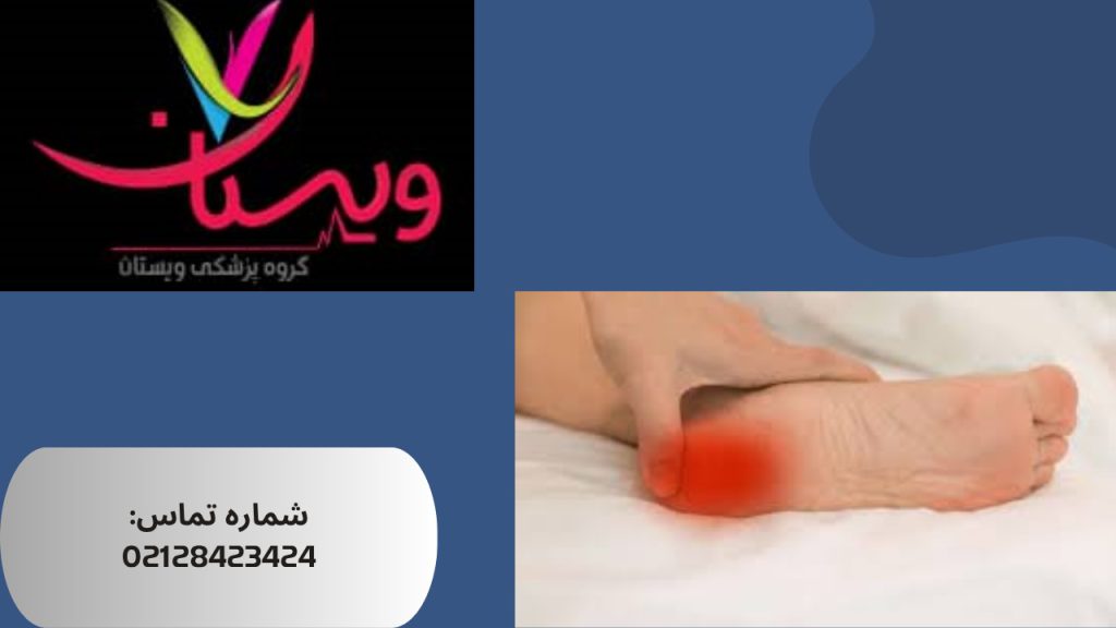 علت‌ها و عوامل خطر التهاب فاشیای کف پا (پلانتار فاشئیت)