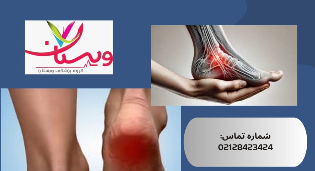 التهاب فاشیای کف پا| علائم، علتها، درمان قطعی 1404