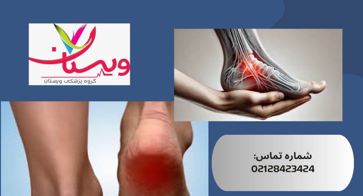 التهاب فاشیای کف پا| علائم، علت‌ها، درمان قطعی 1404