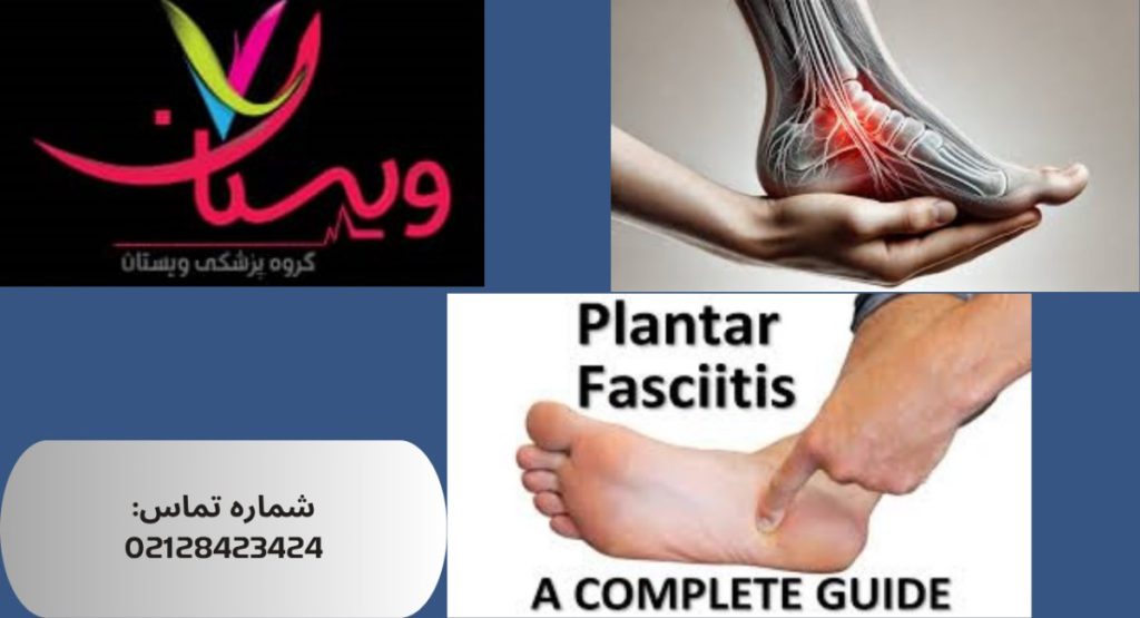 درمان فاشئیت پلانتار (درد کف پا)