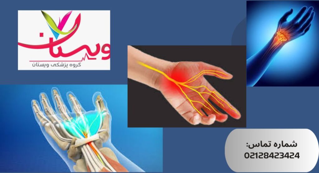 سندروم تونل کارپال(CTS)چیست؟ سندروم تونل کارپال(CTS)چیست؟