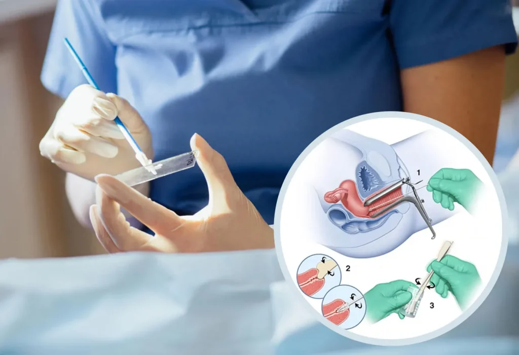چه زمانی بعد از زایمان میتوان پاپ اسمیر انجام داد؟
