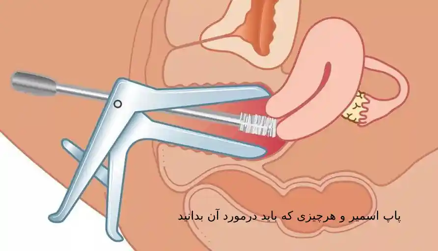پاپ اسمیر و هرچیزی که باید درمورد آن بدانید