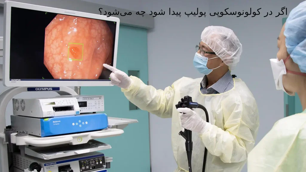 اگر در کولونوسکوپی پولیپ پیدا شود چه میشود؟