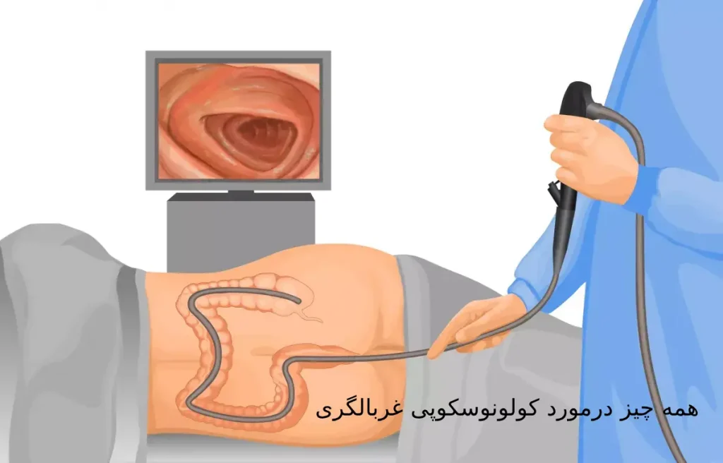 کولونوسکوپی غربالگری و نکات مهمی که باید درمورد آن بدانید