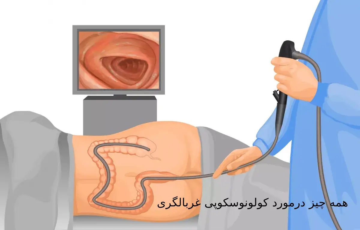 کولونوسکوپی غربالگری و نکات مهمی که باید درمورد آن بدانید