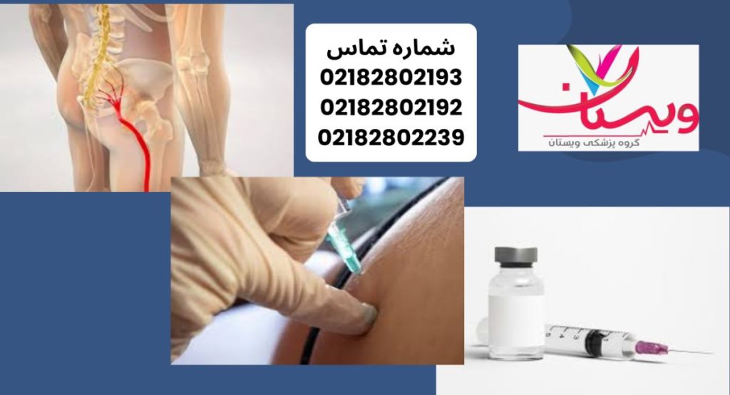آمپول برای گرفتگی رگ سیاتیک