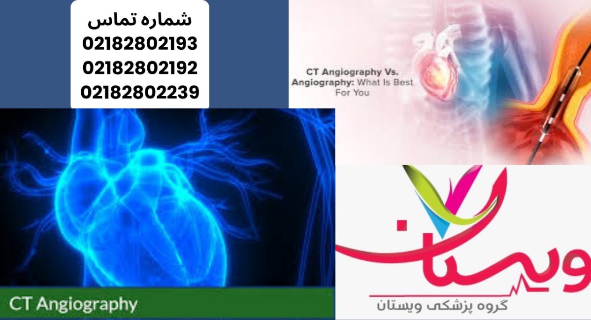 سی‌تی آنژیوگرافی یا آنژیوگرافی؛ کدام بهتر است؟