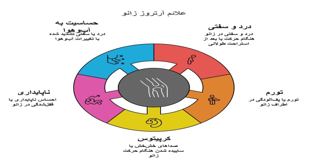 علائم شایع آرتروز زانو