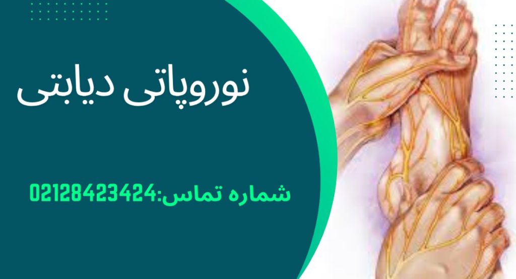 نوروپاتی دیابتی | علائم، علل و راه‌های درمان و پیشگیری1404