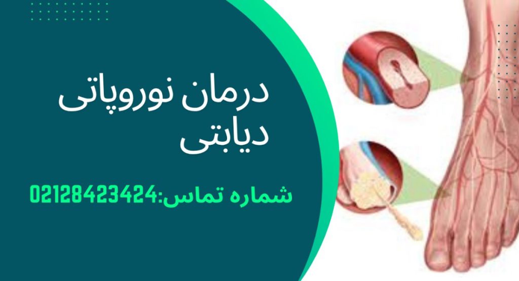 درمان نوروپاتی دیابتی