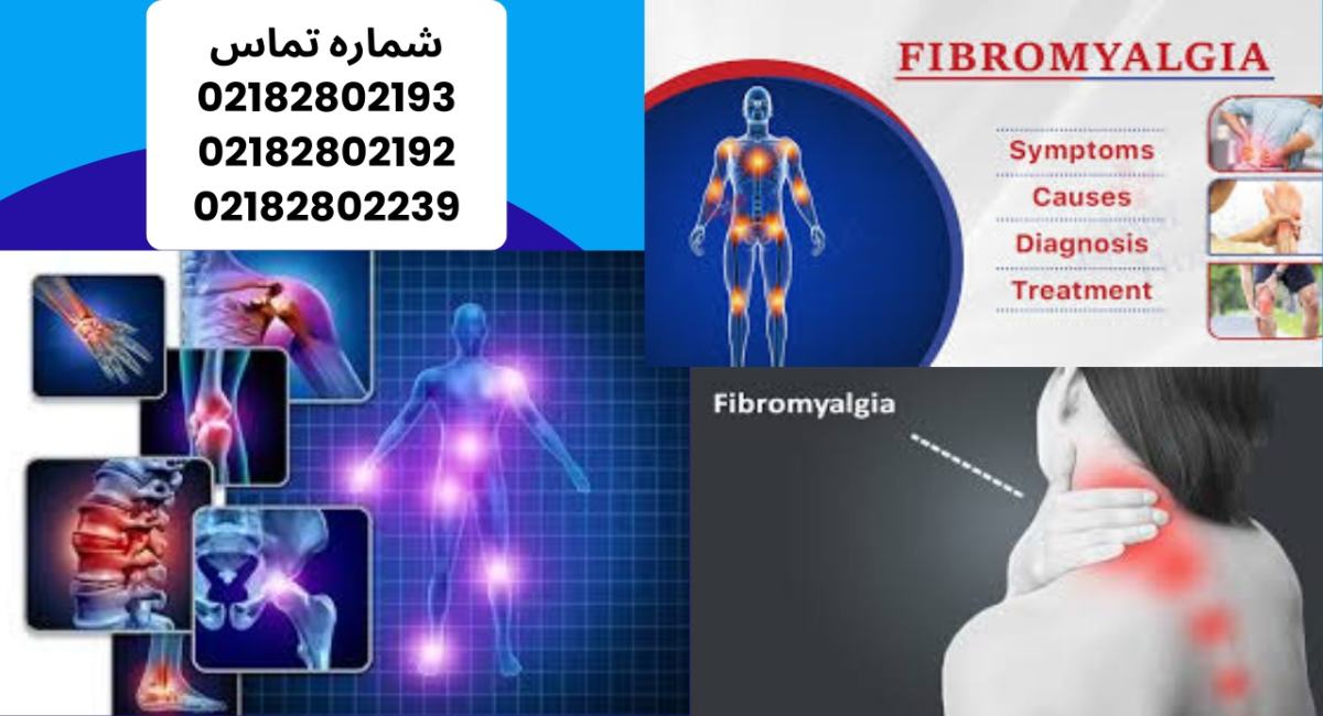 فیبرومیالژیا | علل، علائم، درمان‌های مؤثر 1404
