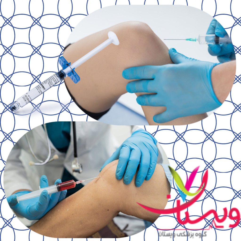 قیمت آمپول ژل زانو در سال1404+5 لیست از قیمت ژل زانو خارجی