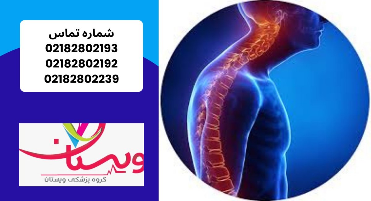 کیفوز یا قوز پشتی | بهترین روش‌ها، تمرینات اصلاحی در کلینیک ویستان 1404