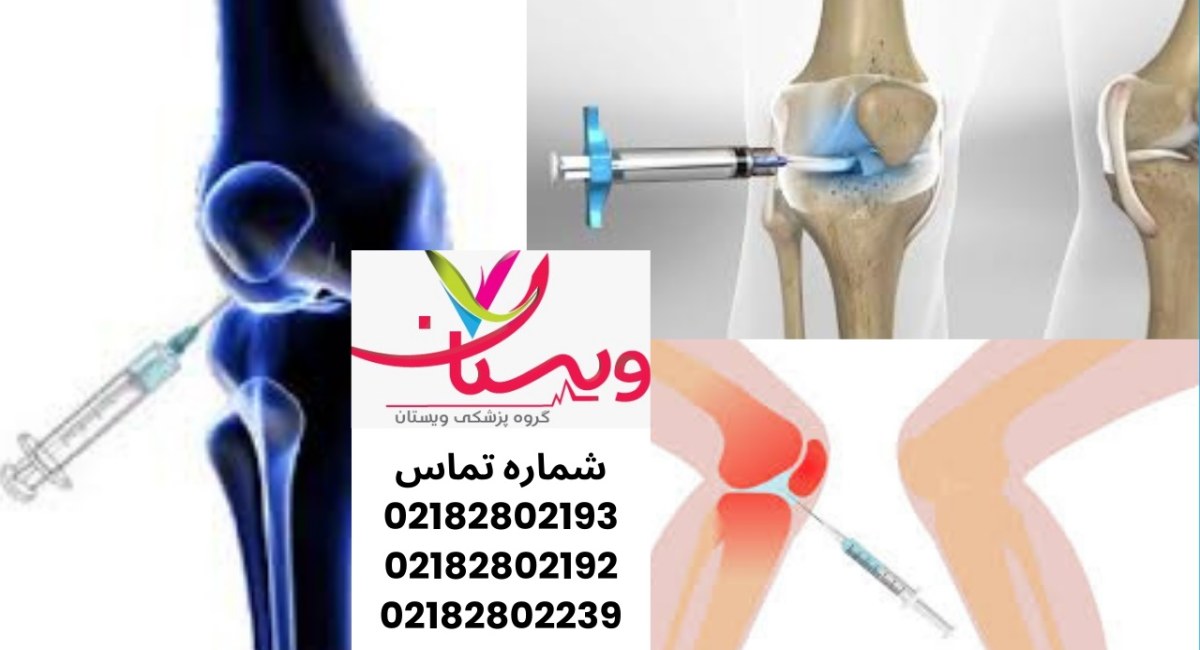 هزینه ارتوکین تراپی
