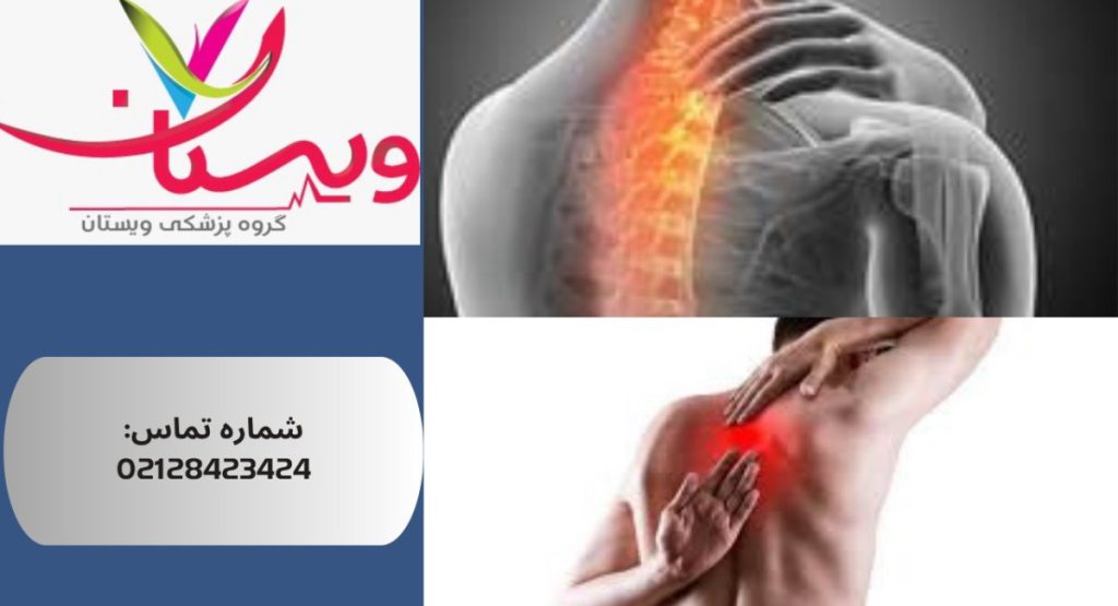 درد بین دو کتف درد بین دو کتف