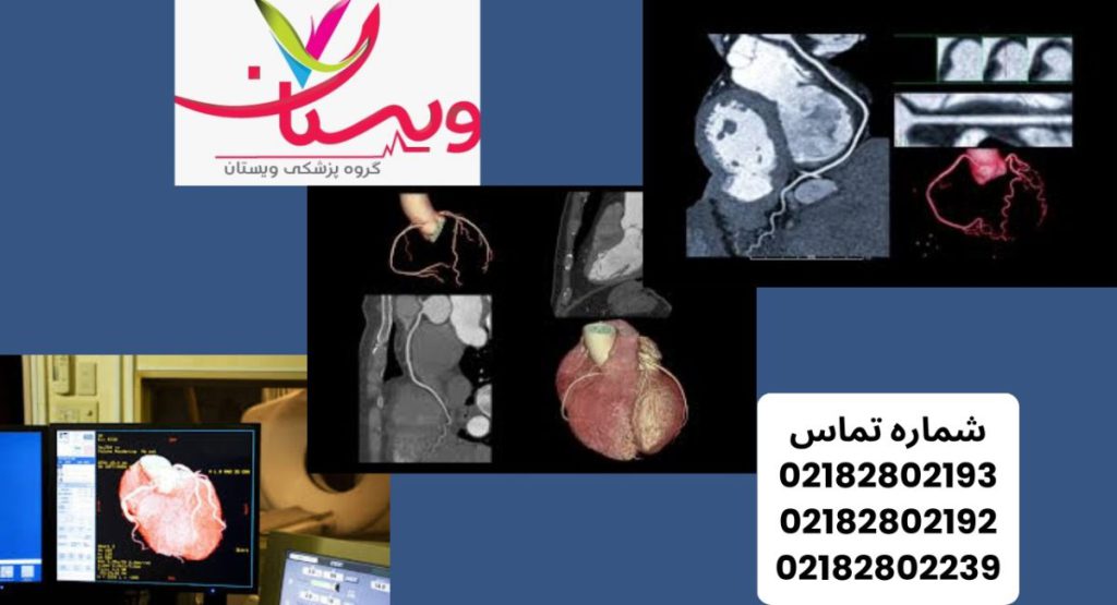 خطرات سی‌تی‌اسکن قلب